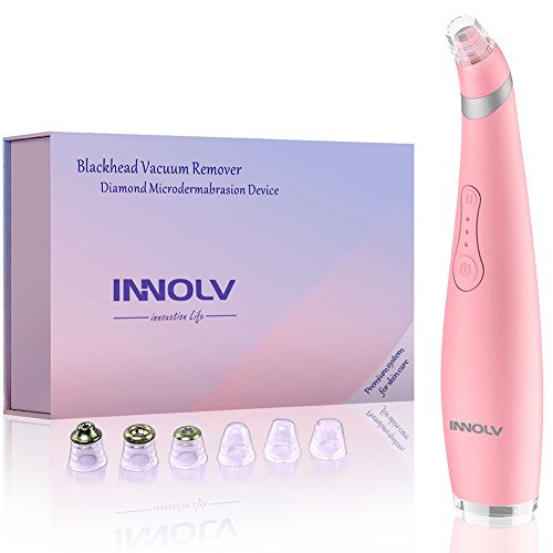 Better than any one I have seen or watched a video on!!! A+