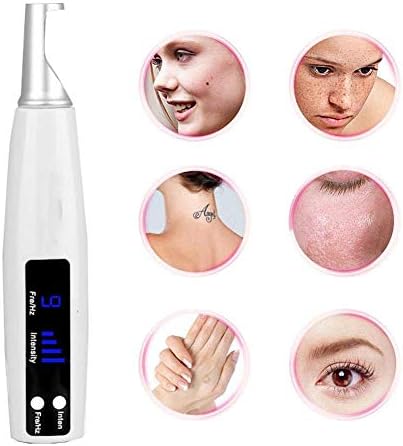 NSWD Spot Tattoo Removal Pen, Skin Mole Freckle Melanin Diluting Remover Machine with 4 Speed 9 Level Beauty Device,BLUELIGHT