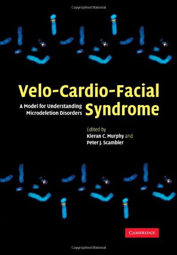 VELO-CARDIO-FACIAL SYNDROME