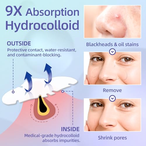10 Pack Nose Strips Hydrocolloid Blackhead Remover Deep Cleansing & Pore Shrinkage Oil Control Acne Blackhead Remover Soft Skin Care for Everything