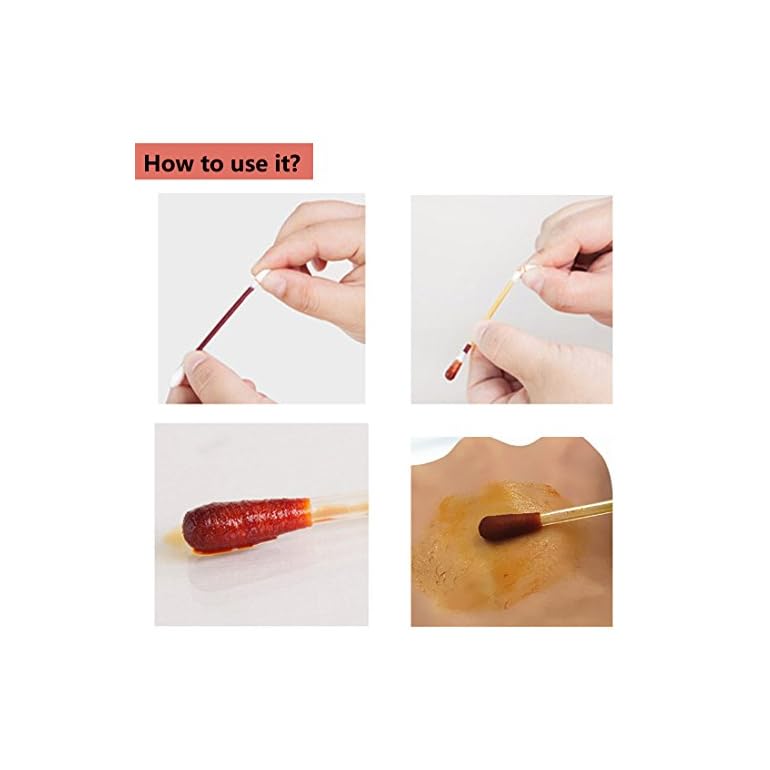 100pcs Disposable Iodine Swab Disinfected Cotton Swab Medical Iodine Cotton Stick Clean Wounds