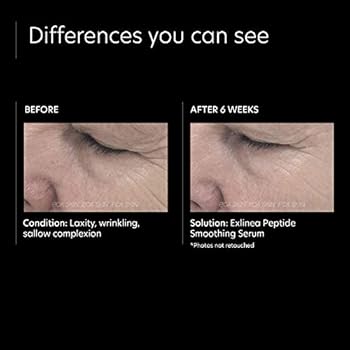 pca peptide smoothing serum