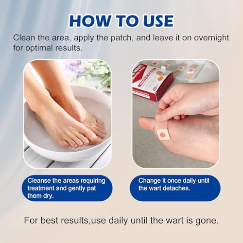 LBOYLOVE® 42 Pack Wart Corn Remover Pads for Feet, 40% Salicylic Acid Wart Remover Pads, Corn Removers for Toes, Extra Strength Bandages for Plantar Warts, Corns, Callus on Feet