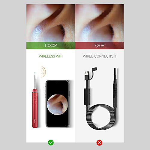 BEBIRD M9 Pro Metal Design Smart Visual Ear Otoscope, 1080P Wireless