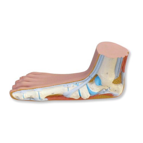 3B Scientific M31 Flat Foot (Pes Planus) Joint Model, 4.7" x 9.4" x 3.9"