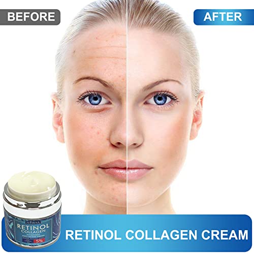 Retinol Cream for Face Facial Moisturizer with Collagen and