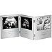 VonHaus Triple Sonogram Picture Frame for Keepsake Ultrasound Pregnancy Scan Images and Baby Photos