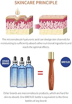 vitamin c eye roller