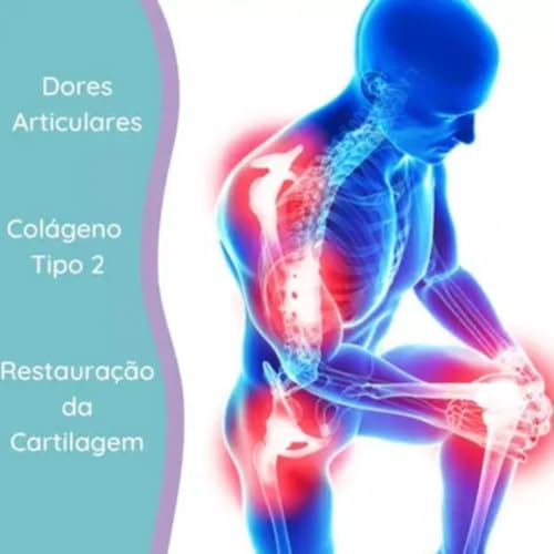 Suplemento Colágeno Tipo 2, UCII, Ácido Hialurônico, Glicosaminoglicano, NEEM Articulice com 30 comprimidos similar Fortice