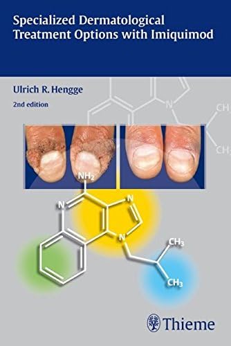Specialized Dermatological Treatment Options with Imiquimod