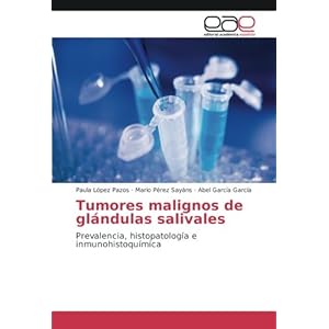 Tumores malignos de glándulas salivales: Prevalencia, histopatología e inmunohistoquímica (Spanish Edition)