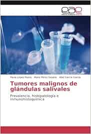 Tumores malignos de glándulas salivales: Prevalencia, histopatología e inmunohistoquímica