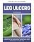 Livro Úlceras nas pernas: um guia rápido para iniciantes sobre como controlar úlceras nas pernas por meio da dieta e outros métodos naturais, com receitas modelo e um plano de refeições de 7 dias