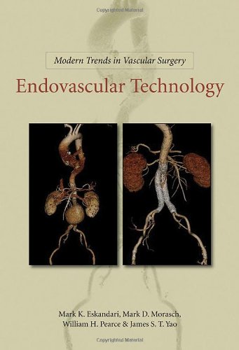 MODERN TRENDS IN VASCULAR SURGERY: ENDOVASCULAR TECHNOLOGY