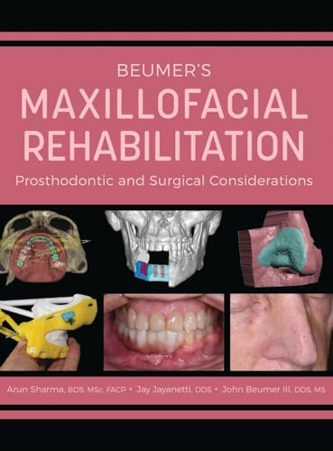 Atlas of Oral and Maxillofacial Pathology: Pogrel MB ChB BDS