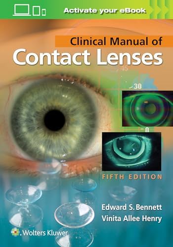 Clinical Management of Binocular Vision: 9781496399731: Medicine