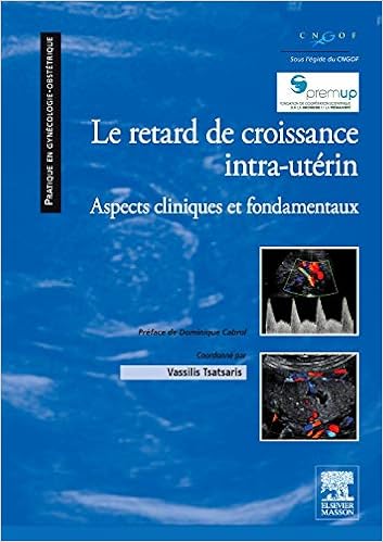 Résultat de recherche d'images pour "le Retard De Croissance Intra-utérin amazon"