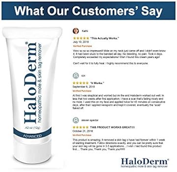 haloderm skin tag remover