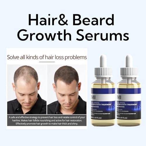 Hair Loss Serum 2 x 50 ml, Hair Growth Serum with Biotin, Lightweight Hair Densifier for Men and Women, Strengthening Hair Serum for Fine, Weak and Damaged Hair, Blue