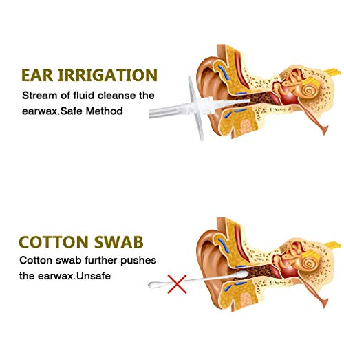 Ear Wax Removal Tool Kit for Ear Cleaning OOCOME Ear Wax Remover Kit for Adults& Kids Ear Syringe Ear Cleaner Irrigation System,Included 1 Ear Washer Bottle,1 Hard Tube,1 Rubber Pipe,5 Disposable Tips