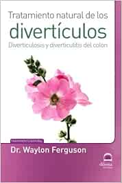 Tratamiento Natural De Los Divertículos. Diverticulosis y Diverticulitis DEL COLON