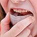 Dental Expert Mouth Guard with Case - 6 Pack - Anti Grind
