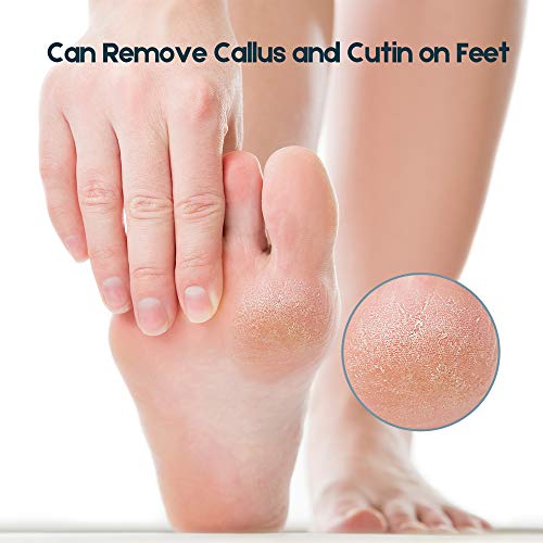 Foot Pumice Stone, Foot Scrubber Callus Remover, Exfoliation to Remove Dead Skin for Foot, Heel, Toes, Dry Dead Skin Scrubber Corn Remover Natural Foot File Massage Spa