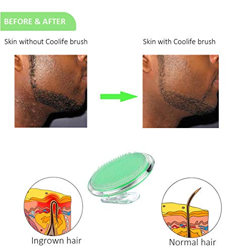 2 Coolife+Keratosis+Treatment+Exfoliator+Cellulite