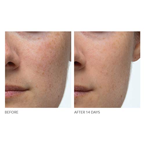 dr dennis gross extra strength daily peel