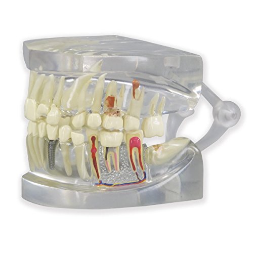 GPI Anatomicals 2861 Mascella Umana con Modello di Denti, Trasparente
