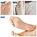 BEALUZ 2 Pairs Exfoliating Foot Peel Mask - Exfoliant for Soft Feet in 1-2 Weeks, Peeling Away Rough Dead Skin & Calluses Repairing Exfoliant , For Men & Women