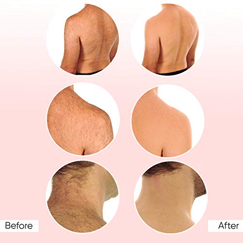 Sensilight Permanent Hair Removal Device for Men. A Home Machine, Using IPL Technology. Great Body and Facial Hair Remover. Can Be Used On The Leg, Back, Chest & Upper Lip (Mini 100,000)