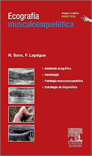Best Of Ecografia musculoesqueletica spanish edition EBook Images