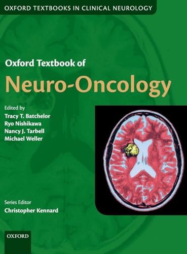 Plum and Posner's Diagnosis and Treatment of Stupor and Coma
