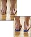 LOTGO Unisex Massaging Insoles for Pain Heel,Achilles Tendonitis and Heel Spurs (Blue, Mens)