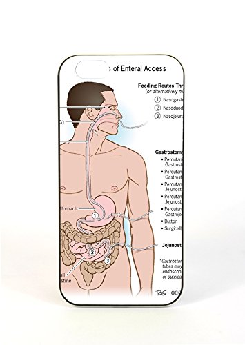 iPhone 6 plus Case Jejunostony Enteral And Parenteral Nutrition Acg Patients iPhone Case