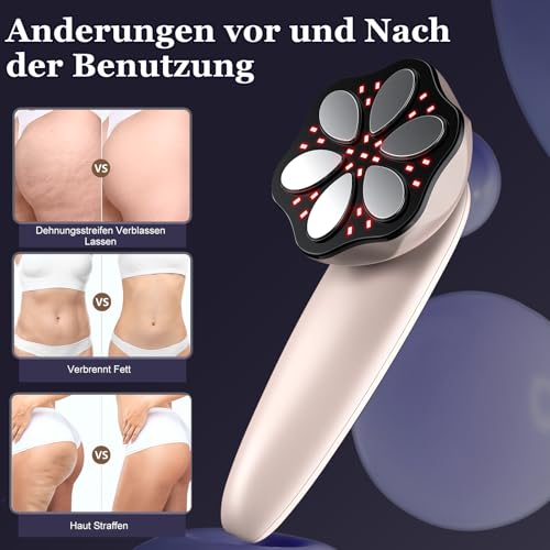Professional Anti-Cellulite Massager, 3 in 1 Professional Anti-Cellulite Massager for Hands Tummy, Waist, Arms, Legs, Buttocks, Unisex, Lifting Effect
