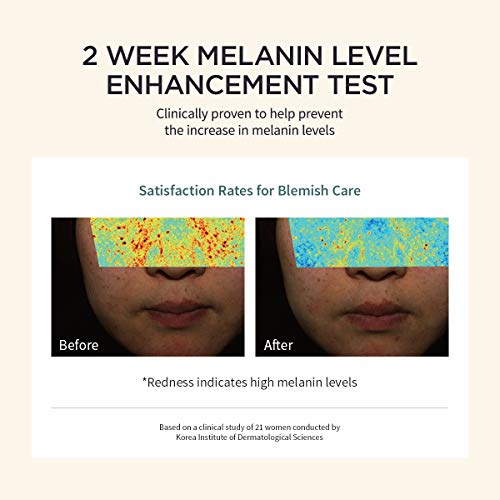 spot treatment for sensitive skin