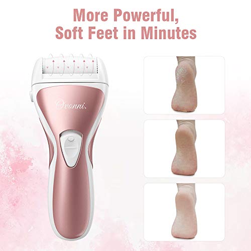 Ovonni Electric Callus Remover, Professional Powerful Rechargeable Foot File for Feet, Portable Cordless Waterproof Callus Shaver with 3 Roller Heads for Dead Hard & Cracked Dry Skin (Gold) - Thumbnail 2