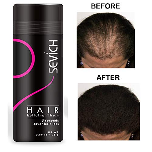 Economy Keratin Hair Building Fibers Instantly Thickens Thinning or Balding Hair for Men and Women - Natural Hair Loss Concealer 0.87oz (Medium Brown) - Thumbnail 7