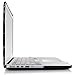 iDOO Hard Plastic Case ONLY for (Previous Generation) MacBook PRO 15 inch (Model A1398) with Retina Display NO CD Drive - Black Marble