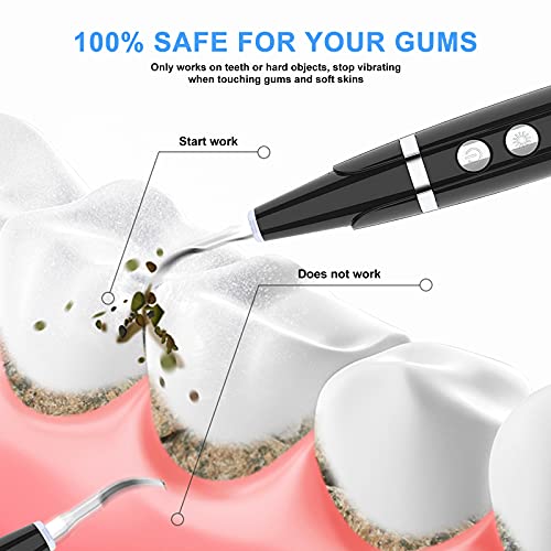 Plaque Remover for Teeth, Ultrasonic Tooth Cleaner Tartar Remover Calculus Remover Tooth Stains