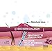 Epiderm Areola Circles – Silicone Scar Sheets for Surgical Scars from Areola Reconstruction & Breast Augmentation - Washable & Reusable Silicone Sheets - Complements Mastopexy Forms - 1 Pair, Clear