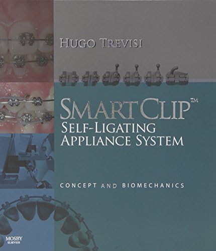SmartClip Self-Ligating Appliance System,: Concept and Biomechanics