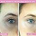 Wrinkles Schminkles Under Eye Wrinkle Patches, Smooth Eye Wrinkles, Crows Feet & Dark Circles Overnight, 1 Pair Reusable Medical Grade Silicone Patches