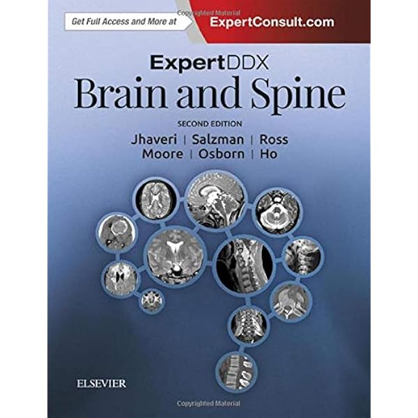 洋書 Expert ddx brain and spine ExpertDDx: Brain and Spine E-Book / Salzman MD, Karen L./Jhaveri