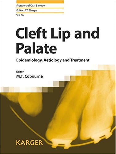 Cleft Lip and Palate: Epidemiology, Aetiology and Treatment: 16 (Frontiers of Oral Biology)