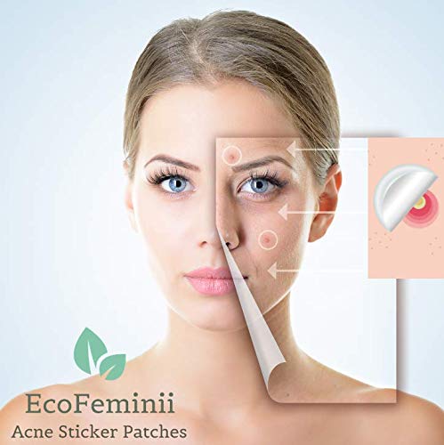 EcoFeminii Pack of 108 Targeted Acne Treatment Sticker Patches - Absorbing Hydrocolloid Covers for Spot Repair - Transparent Dots for Blemishes - Natural and Effective on Oily or Combination Skin - Overnight Acne, Spot and Blackhead Treatme