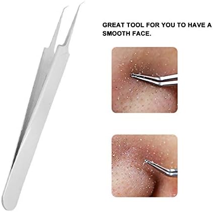 Amazon Co Jp 1本ニキビ取り角栓 ピンセット 抗菌ステンレス 毛穴ケア 黒ずみ取り 毛穴角栓すっきり 専用ケース付き ビューティー