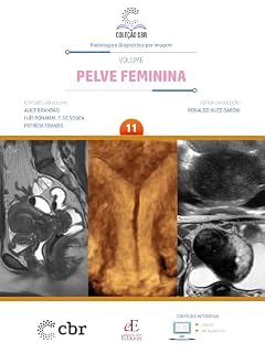 Livro Coleção CBR Volume 11 Pelve Feminina: Coleção CBR Radiologia e Diagnóstico por Imagem